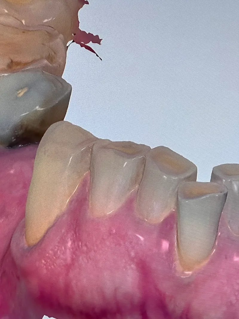 Aspen Dental #4225