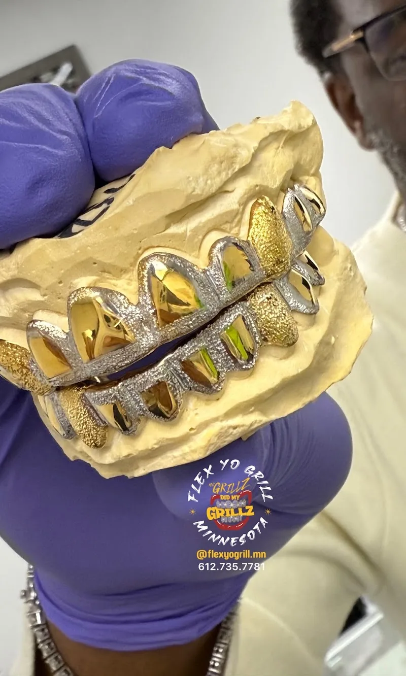Flex Yo Grill Minnesota LLC