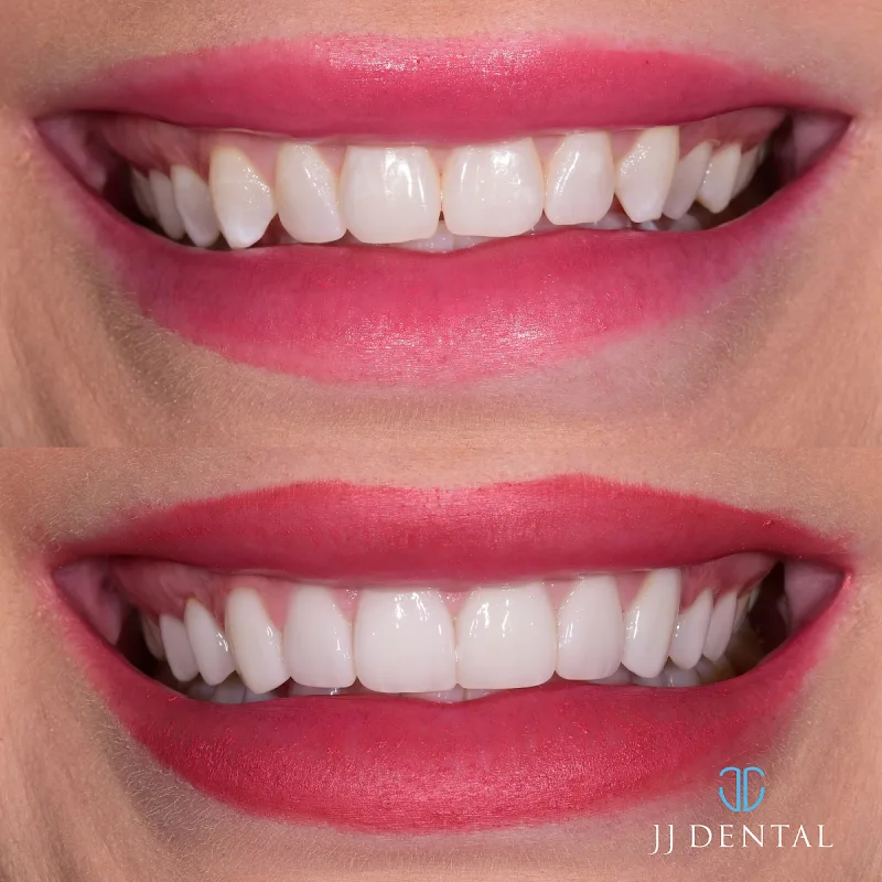JJ Dental 3 Inc (AC)