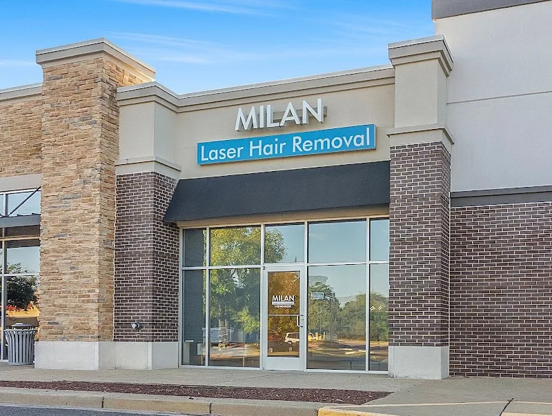 Milan Laser - Memphis