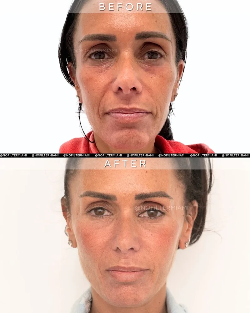 NoFilterMedSpa LLC (AC)