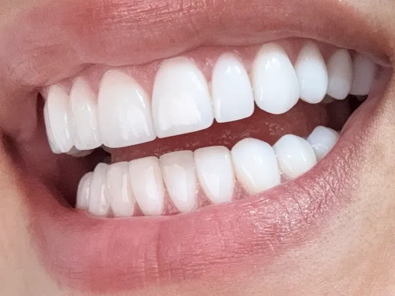 Paris Smiles Design
