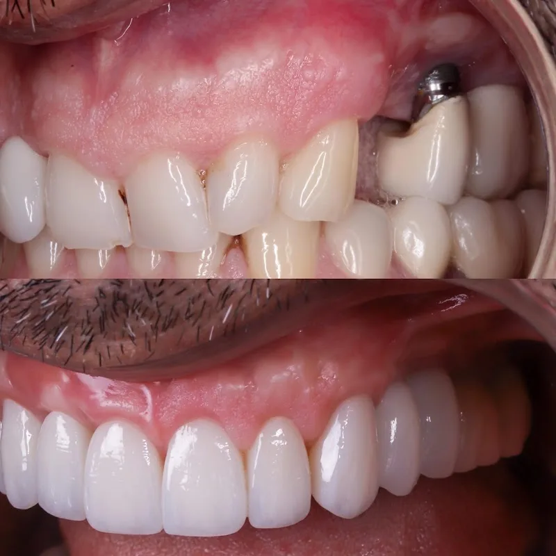 Super Dentist Miami Corp (AC)